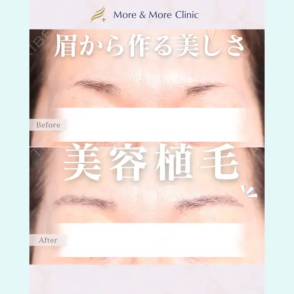 More ＆ More Clinic ホ・ヤンフェ医師の症例