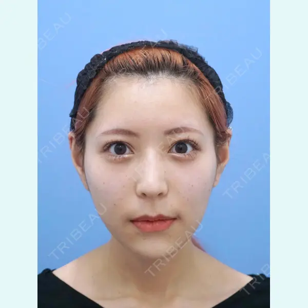 湘南美容クリニック 秋葉原院 名倉 俊輔医師の症例