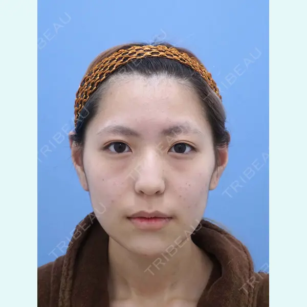 湘南美容クリニック 秋葉原院 名倉 俊輔医師の症例