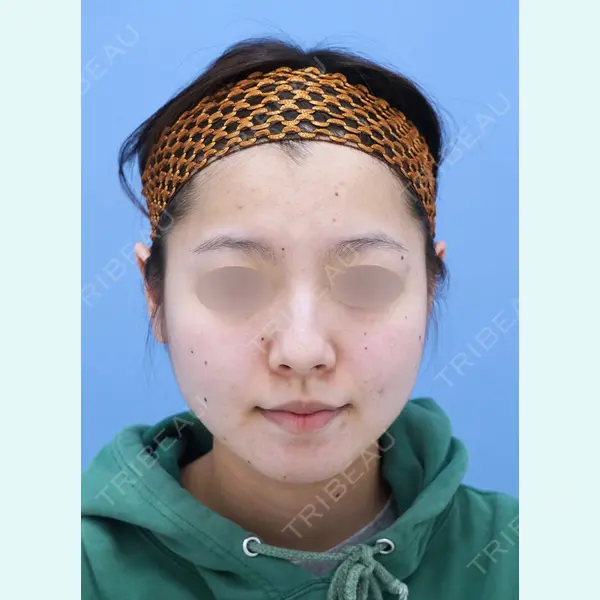 湘南美容クリニック 秋葉原院 名倉 俊輔医師の症例