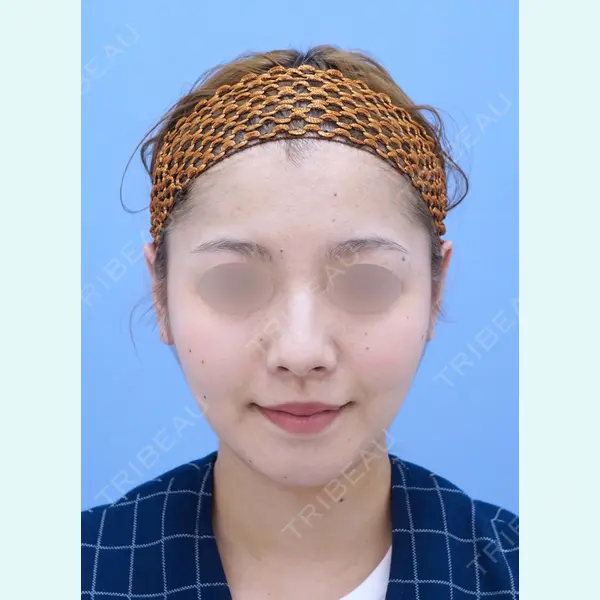 湘南美容クリニック 秋葉原院 名倉 俊輔医師の症例