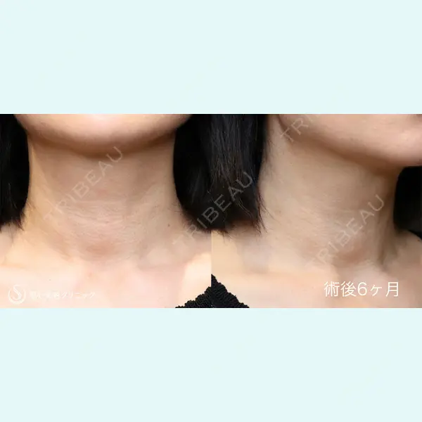 聖心美容クリニック 銀座院 川端 優也医師の症例