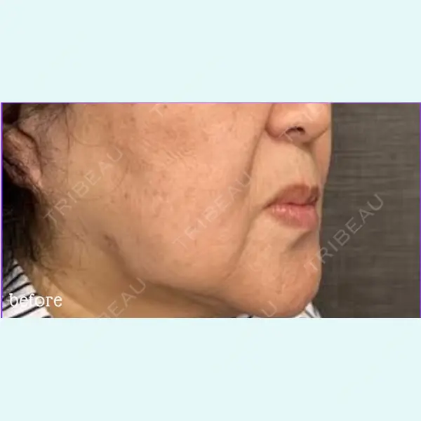 神戸スイミー皮膚科美容外科の症例