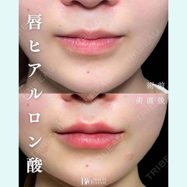 BITO BEAUTY CLINIC 伊藤 富良野医師の症例