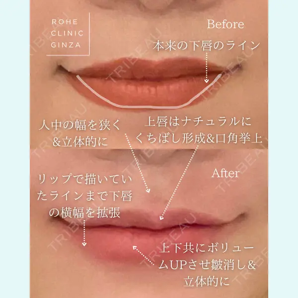 ROHE CLINIC GINZAの症例