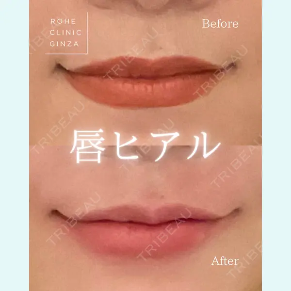 ROHE CLINIC GINZAの症例