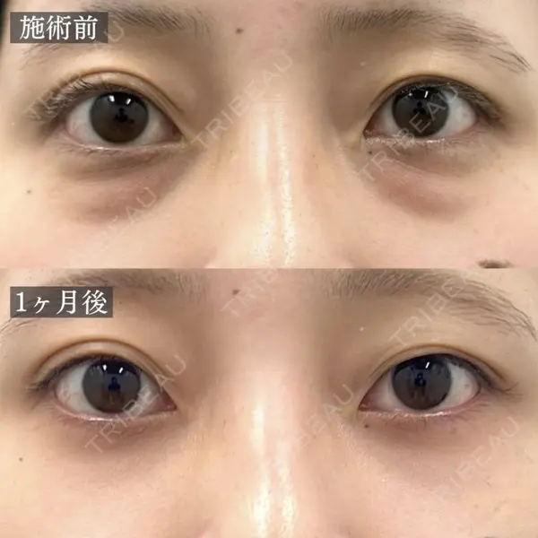 TCB東京中央美容外科 福島院の症例