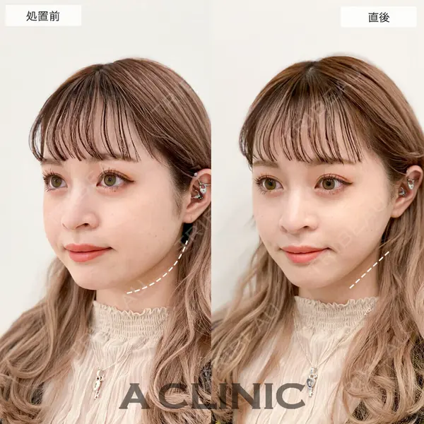 A CLINIC（エークリニック） 仙台院 伊藤 瑠桂医師の症例
