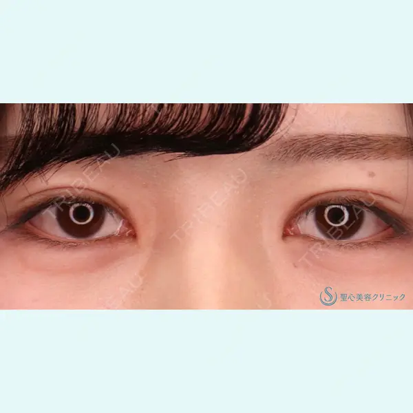 聖心美容クリニック 六本木院 菱田 健作医師の症例