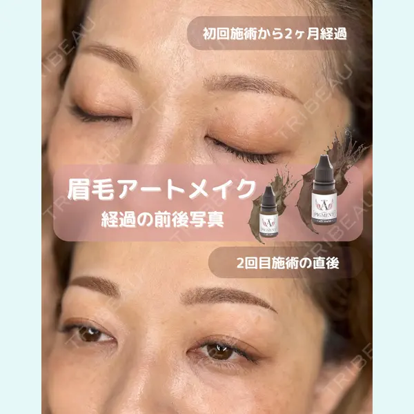 M'sクリニック【エムズクリニック】 永山　詩織（アートメイク施術者）医師の症例