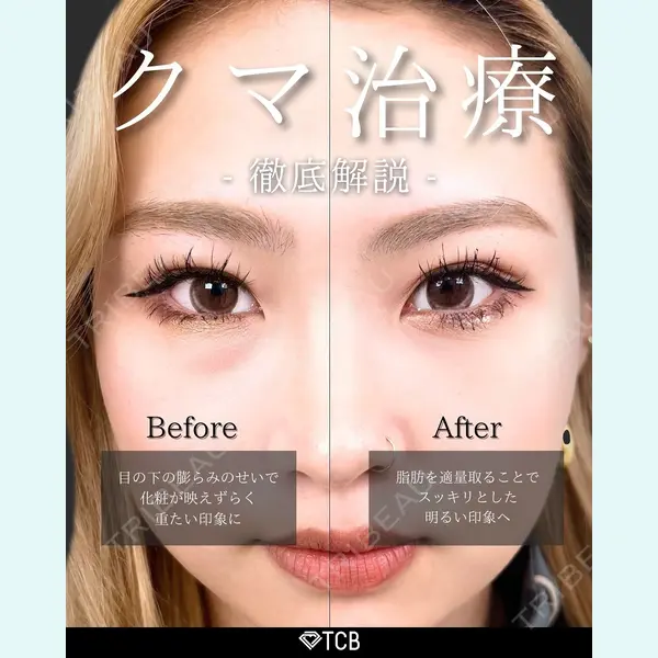TCB東京中央美容外科 新宿三丁目院 篠永 宏行医師の症例