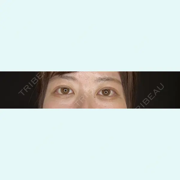 共立美容外科 銀座院の症例