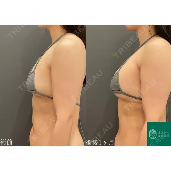 オアシス美容外科 遠藤 剛史医師の症例