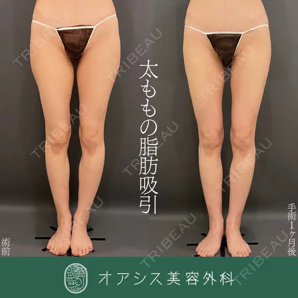オアシス美容外科 遠藤 剛史医師の症例