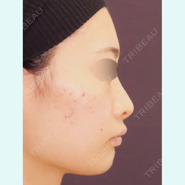 MAe Clinic 東京院 前田 翔医師の症例