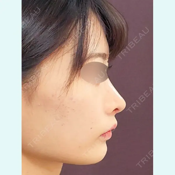 MAe Clinic 東京院 前田 翔医師の症例