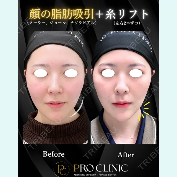 PRO CLINIC プロクリニック 銀座院 洪 嵩典医師の症例