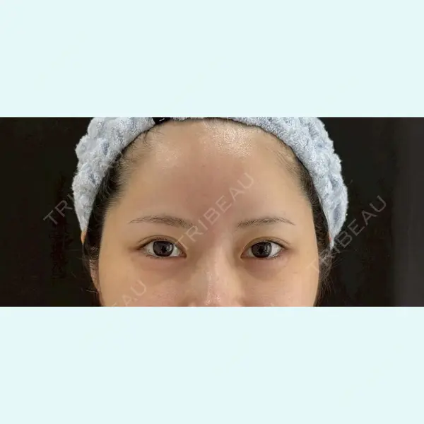 麻布台美容皮膚科クリニック 岡田 楽史医師の症例