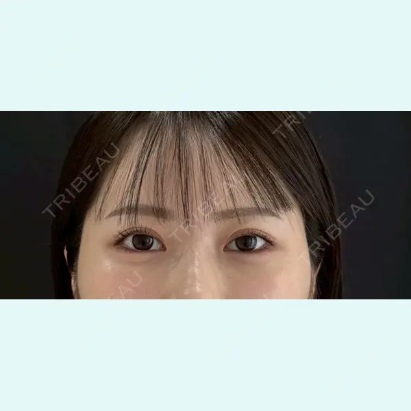 麻布台美容皮膚科クリニック 岡田 楽史医師の症例