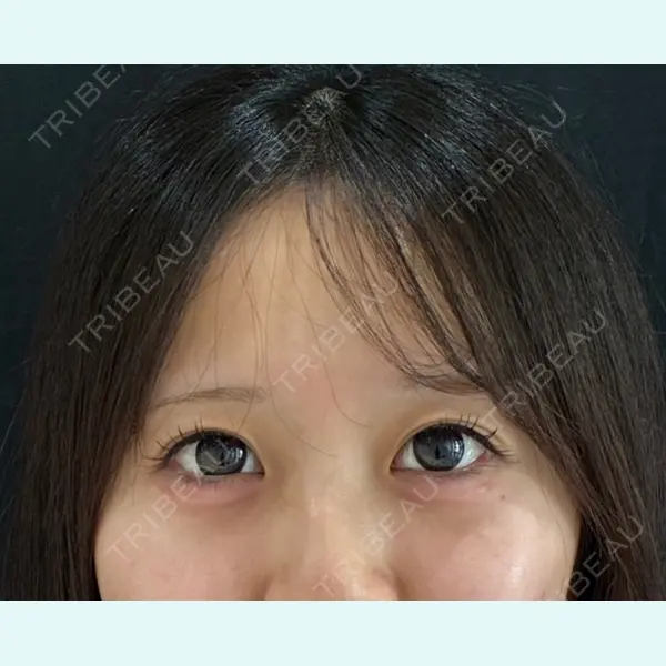 麻布台美容皮膚科クリニック 岡田 楽史医師の症例