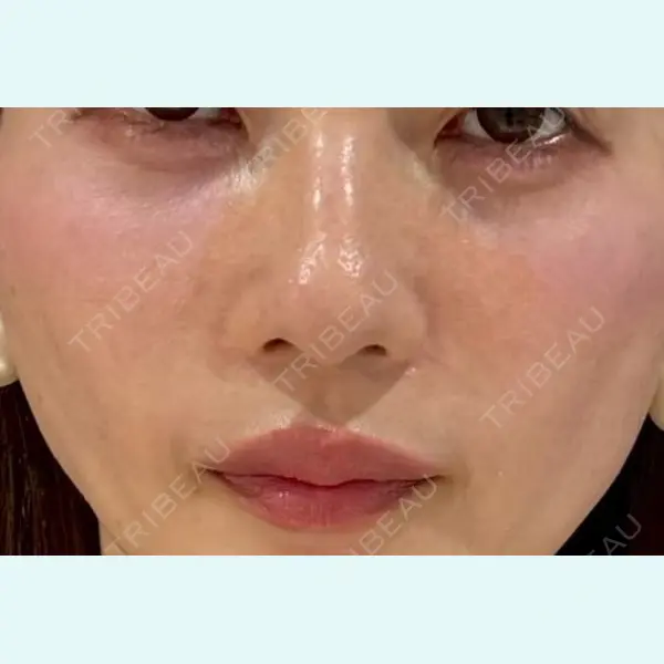 麻布台美容皮膚科クリニック 岡田 楽史医師の症例