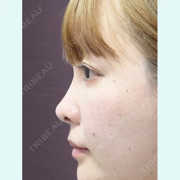 MAe Clinic 東京院 前田 翔医師の症例