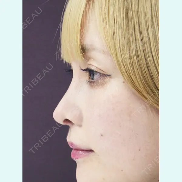 MAe Clinic 東京院 前田 翔医師の症例