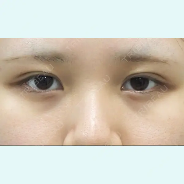 下北沢スキンクリニック 保坂 宗孝医師の症例