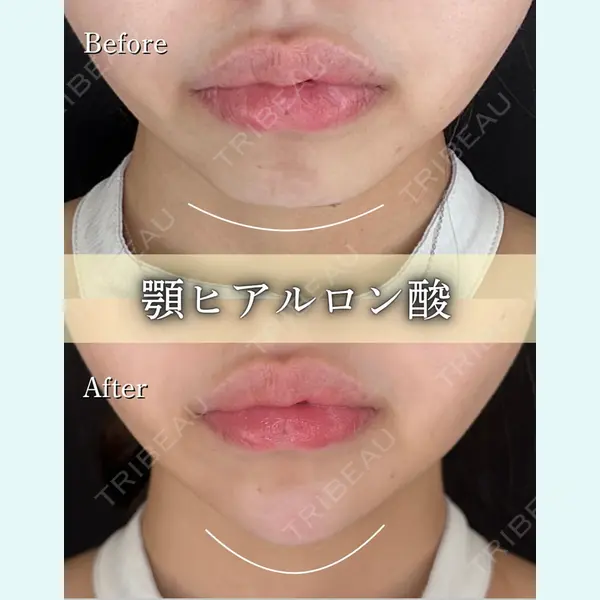 ルラ美容クリニック 京都院の症例
