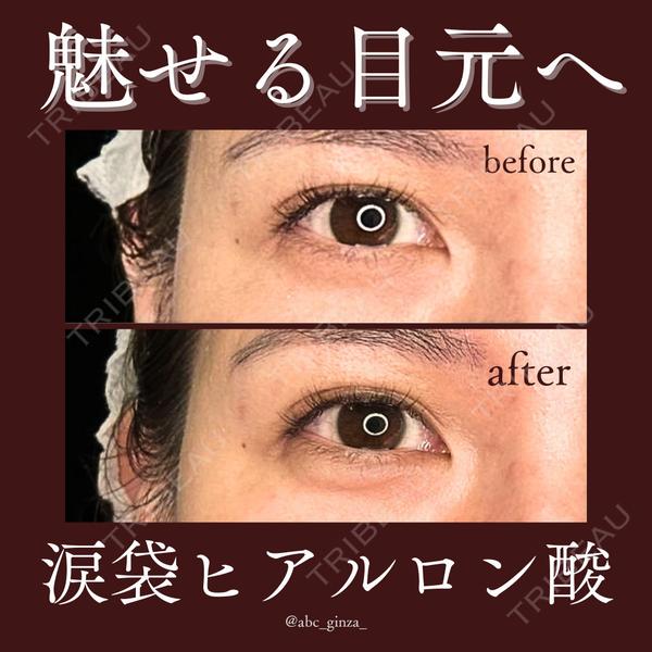 芦屋美容クリニック 銀座院 小西　和人医師の症例