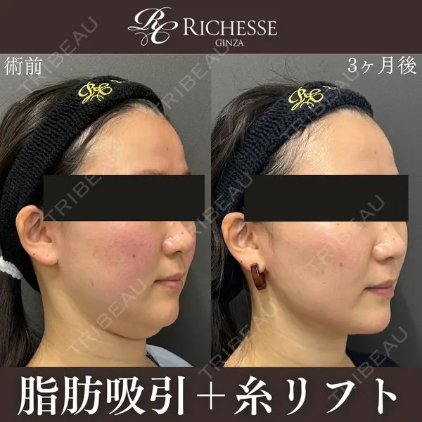 銀座リシェスクリニック 平岡 美樹子医師の症例