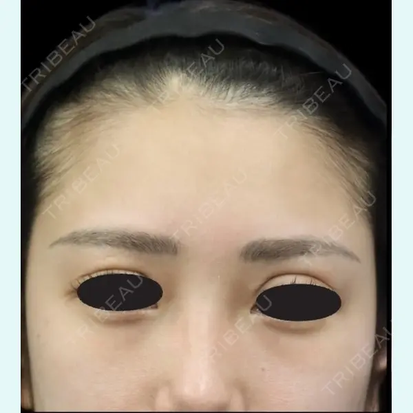 下北沢スキンクリニック 保坂 宗孝医師の症例