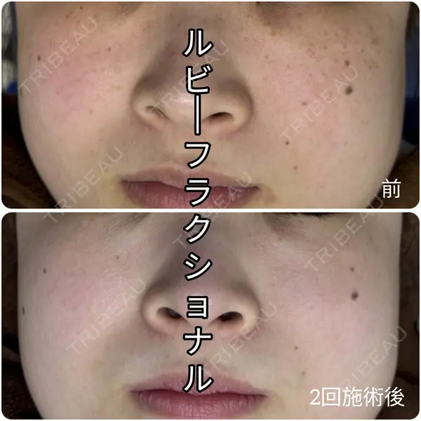 ゆきスキンクリニック 東池袋 小林 智之医師の症例