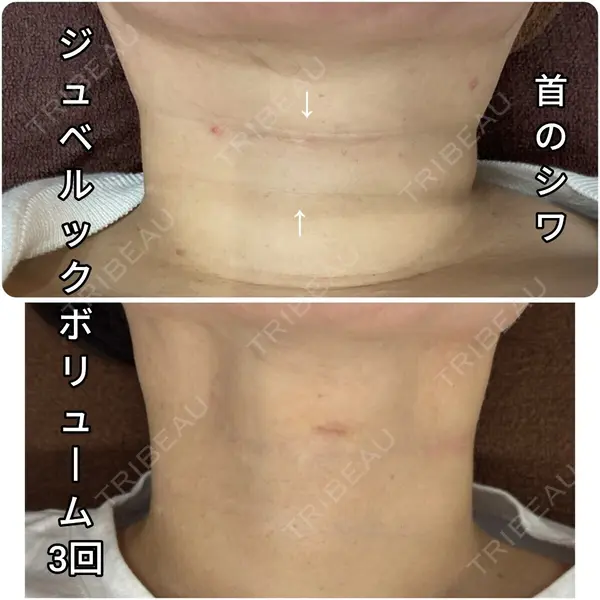 ゆきスキンクリニック 東池袋の症例