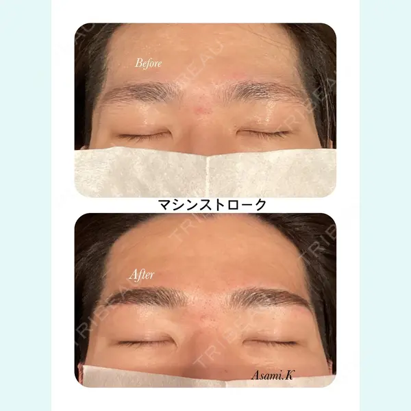 心斎橋KT美容クリニック 唐川 あさみ医師の症例