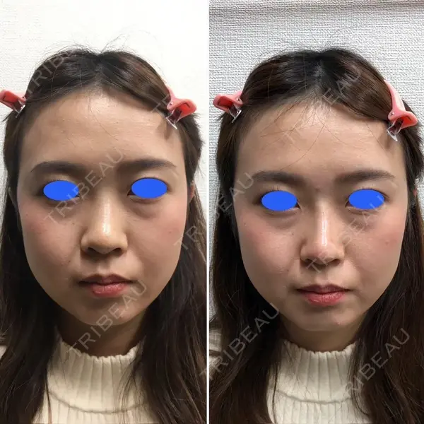 しのぶ皮膚科 蘇原しのぶ医師の症例