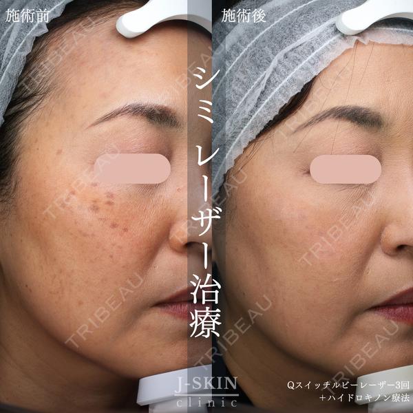 Jスキンクリニック 【J-SKIN clinic】 牧野　潤医師の症例