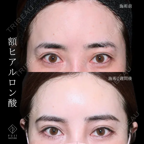 藤・ナチュレ美容クリニック 銀座院 小川 杏平医師の症例