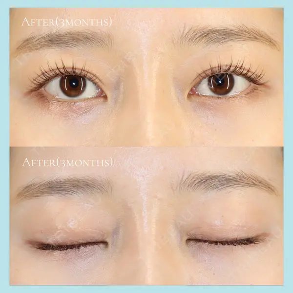 R.O.clinic 呂 秀彦医師の症例