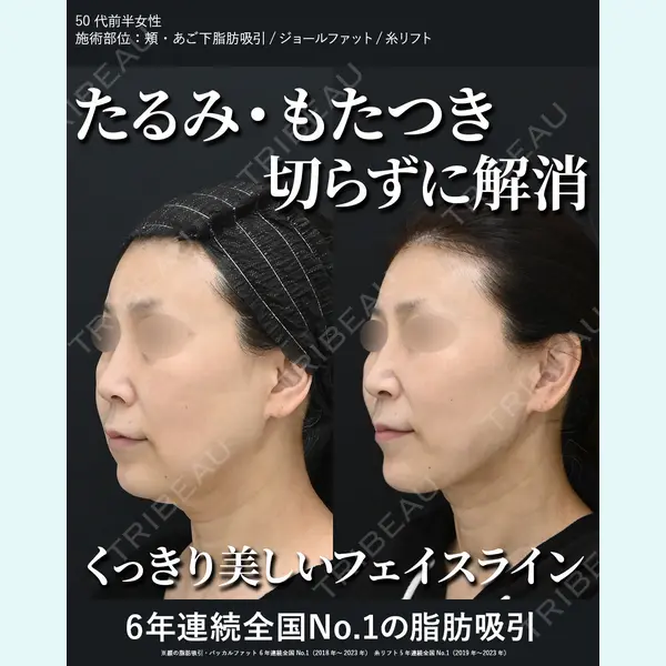 湘南美容クリニック 秋葉原院 名倉 俊輔医師の症例