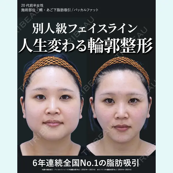 湘南美容クリニック 秋葉原院の症例