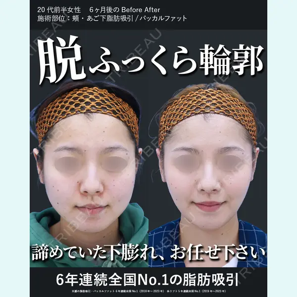 湘南美容クリニック 秋葉原院 名倉 俊輔医師の症例