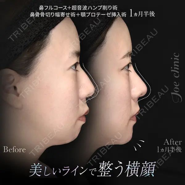 ジョウクリニック 高知院 溝渕　貴俊医師の症例