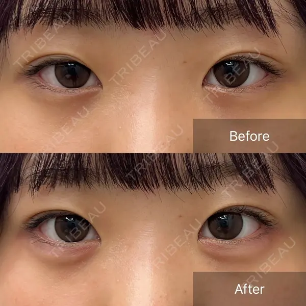 CHARIS BEAUTY CLINIC 木畑智哲医師の症例