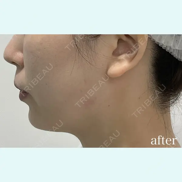 ユウコ形成外科クリニック 植田　有子医師の症例