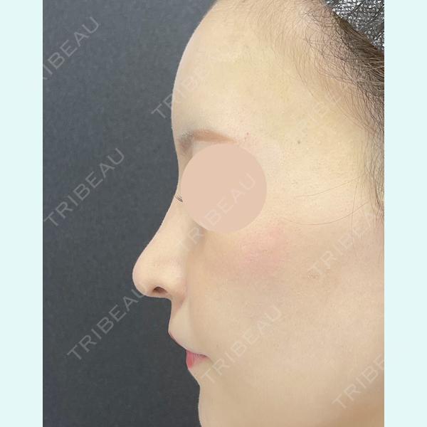 X CLINIC 恵比寿院の症例