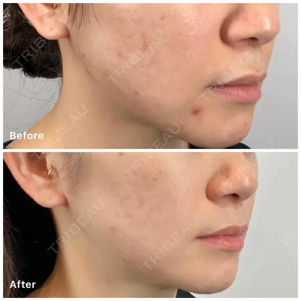 oneUPclinicの症例