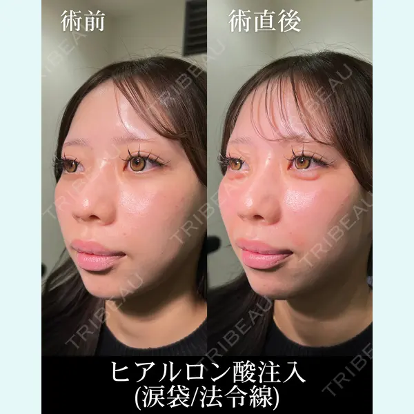 HAAB×DREAM BEAUTY CLINIC 大阪梅田院 錦 実奈医師の症例
