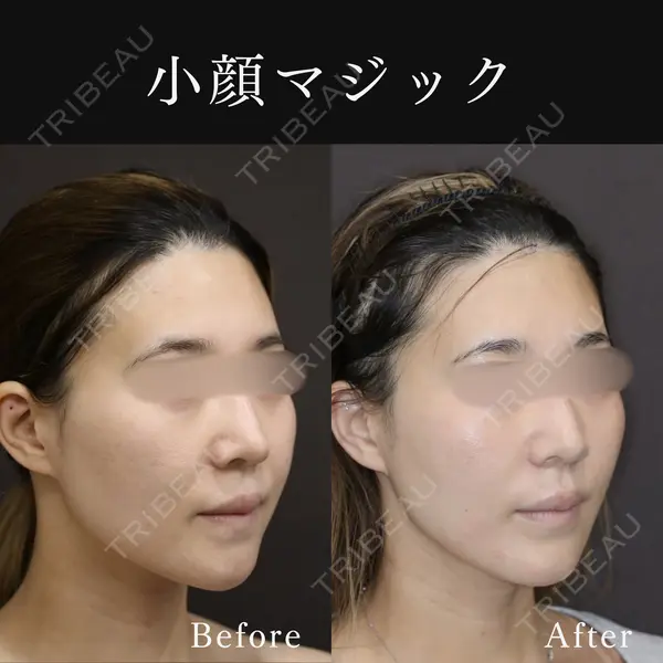 東京ココセランクリニック 篠﨑 智公医師の症例