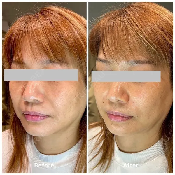 oneUPclinic 笹井 哉臣医師の症例